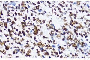 Immunohistochemistry of paraffin-embedded Human appendix using Acetyl-Histone H4-K12 Polyclonal Antibody at dilution of 1:200 (40x lens). (Histone H4 anticorps  (acLys12))