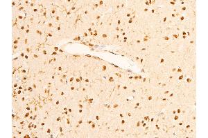ABIN6267286 at 1/100 staining rat brain tissue sections by IHC-P. (TRKA anticorps  (pTyr681, Tyr680))