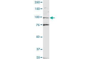 ZNF598 polyclonal antibody (A01).