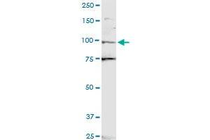 ZNF598 polyclonal antibody (A01). (ZNF598 anticorps  (AA 28-126))