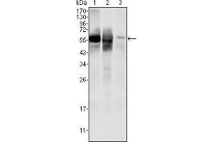 Western blot analysis using GPI mouse mAb against HepG2 (1) , SMMC-7721 (2) cell lysate and rat liver tissues lysate (3).