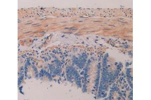 Used in DAB staining on fromalin fixed paraffin- embedded intestine tissue (MAP1A anticorps  (AA 2110-2367))