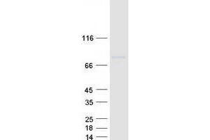Validation with Western Blot