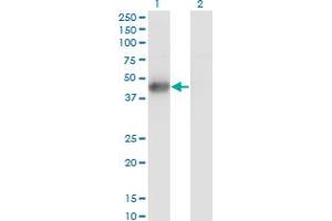 Western Blot analysis of MKNK2 expression in transfected 293T cell line by MKNK2 monoclonal antibody (M07), clone 2A10.