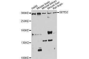 Western blot analysis of extracts of various cell lines, using SETD2 antibody. (SETD2 anticorps)