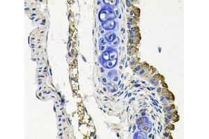 Immunohistochemistry of paraffin-embedded Mouse lung using MARK1 Polyclonal Antibody at dilution of 1:100 (40x lens). (MARK1 anticorps)