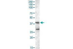 SKAP2 polyclonal antibody  staining (0.