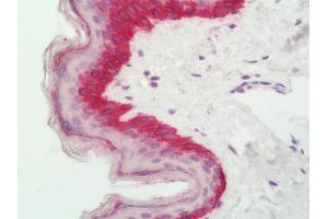 Human Skin: Formalin-Fixed, Paraffin-Embedded (FFPE)