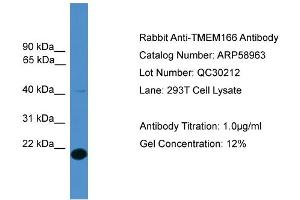 WB Suggested Anti-TMEM166  Antibody Titration: 0. (TMEM166 anticorps  (Middle Region))