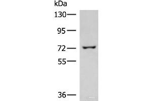 Western blot analysis of 293T cell lysate using GLS Polyclonal Antibody at dilution of 1:850