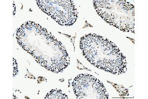 IHC analysis of MCM6 using anti-MCM6 antibody (ABIN7600037). (MCM6 anticorps  (AA 14-821))