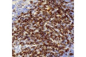 Immunohistochemistry of paraffin embedded mouse splenitis using CD3 (ABIN7073386) at dilution of 1: 3000 (400x lens)