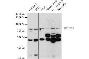 Western blot analysis of extracts of various cell lines, using KBTBD3 antibody (ABIN7268075) at 1:1000 dilution. (KBTBD3 anticorps  (AA 520-612))