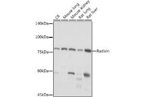 Western blot analysis of extracts of various cell lines, using Radixin Rabbit mAb (ABIN7269833) at 1:1000 dilution. (Radixin anticorps)