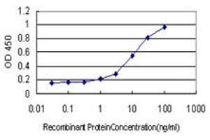 Detection limit for recombinant GST tagged LAMC1 is approximately 0.