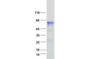 Validation with Western Blot