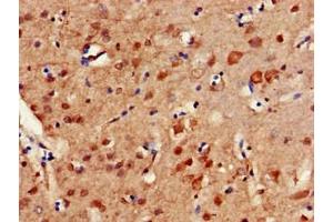 Immunohistochemistry of paraffin-embedded human brain tissue using ABIN7150279 at dilution of 1:100
