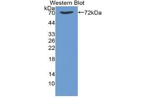 Detection of Recombinant HSPA1B, Bovine using Monoclonal Antibody to Heat Shock 70 kDa Protein 1B (HSPA1B) (HSPA1B anticorps  (AA 1-641))