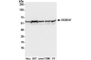 Western Blotting (WB) image for anti-Coiled-Coil Domain Containing 47 (CCDC47) (AA 1-50) antibody (ABIN7450078)