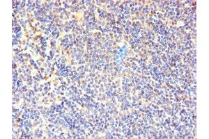 Immunohistochemistry of paraffin-embedded human lymphoid tissue using ABIN7171334 at dilution of 1:100 (CD7 anticorps  (AA 26-180))
