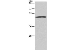 Western Blot analysis of 293T cell using HTR2B Polyclonal Antibody at dilution of 1:500 (Serotonin Receptor 2B anticorps)