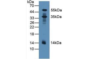 Detection of PDXK in Human Lung Tissue using Polyclonal Antibody to Pyridoxal Kinase (PDXK)