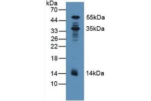 Detection of PDXK in Human Lung Tissue using Polyclonal Antibody to Pyridoxal Kinase (PDXK) (PDXK anticorps  (AA 29-253))