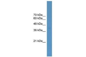 WB Suggested Anti-ELK4 Antibody Titration:  0. (ELK4 anticorps  (C-Term))
