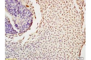 Formalin-fixed and paraffin embedded mouse tooth germ tissue labeled with Anti-Nanog Polyclonal Antibody , Unconjugated at 1:200, followed by conjugation to the secondary antibody and DAB staining