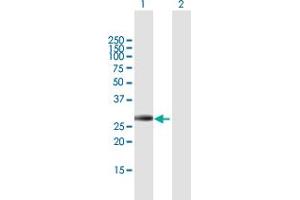 Western Blot analysis of IGFBP4 expression in transfected 293T cell line by IGFBP4 MaxPab polyclonal antibody. (IGFBP4 anticorps  (AA 1-258))