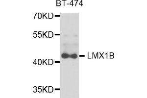 Western blot analysis of extracts of BT-474 cells, using LMX1B antibody.