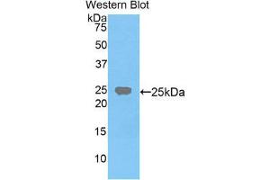 Western Blotting (WB) image for anti-Farnesyl-Diphosphate Farnesyltransferase 1 (FDFT1) (AA 217-416) antibody (ABIN3206187) (FDFT1 anticorps  (AA 217-416))