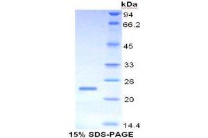 SDS-PAGE analysis of Human Mucin 4 Protein.