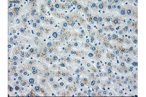 Immunohistochemical staining of paraffin-embedded liver tissue using anti-CHEK2mouse monoclonal antibody. (CHEK2 anticorps)