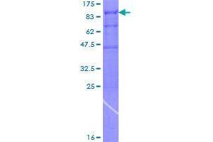 Image no. 1 for ADP-Ribosylation Factor GTPase Activating Protein 3 (ARFGAP3) (AA 1-516) protein (GST tag) (ABIN1345474)