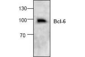 Image no. 1 for anti-B-Cell CLL/lymphoma 6 (BCL6) (C-Term) antibody (ABIN127089) (BCL6 anticorps  (C-Term))