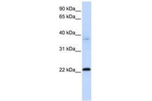 Image no. 1 for anti-Chromosome 11 Open Reading Frame 74 (C11ORF74) (C-Term) antibody (ABIN6741150) (C11ORF74 anticorps  (C-Term))