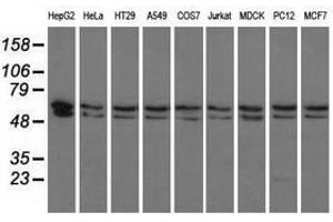 Image no. 3 for anti-Pantothenate Kinase 2 (PANK2) antibody (ABIN1500026) (PANK2 anticorps)