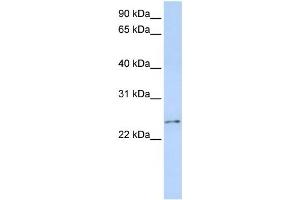Western Blotting (WB) image for anti-RCAN Family Member 3 (RCAN3) antibody (ABIN2458527)
