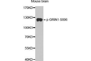Western Blotting (WB) image for anti-Glutamate Receptor, Ionotropic, N-Methyl D-Aspartate 1 (GRIN1) (pSer896) antibody (ABIN1681627) (GRIN1/NMDAR1 anticorps  (pSer896))