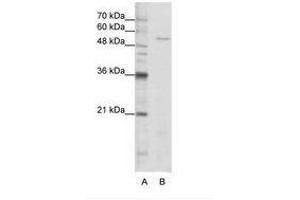 Image no. 1 for anti-Serine--tRNA Ligase, Cytoplasmic-Like (AA 241-290) antibody (ABIN202696) (Serine--tRNA Ligase, Cytoplasmic-Like (AA 241-290) anticorps)