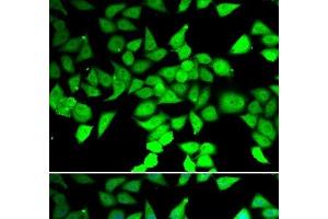 Immunofluorescence analysis of MCF-7 cells using HDAC7 Polyclonal Antibody (HDAC7 anticorps)