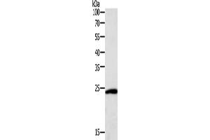 Gel: 12 % SDS-PAGE, Lysate: 40 μg, Lane: Hela cells, Primary antibody: ABIN7131115(SNAP25 Antibody) at dilution 1/400, Secondary antibody: Goat anti rabbit IgG at 1/8000 dilution, Exposure time: 10 seconds