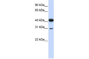 WB Suggested Anti-OVOL2 Antibody Titration:  0. (OVOL2 anticorps  (N-Term))