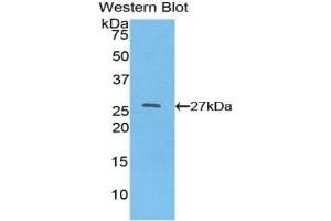 Detection of Recombinant HNF4a, Human using Polyclonal Antibody to Hepatocyte Nuclear Factor 4 Alpha (HNF4a) (HNF4A anticorps  (AA 131-330))