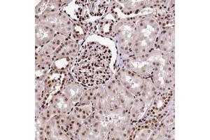 Immunohistochemical staining of human kidney with PDS5B polyclonal antibody  shows strong nuclear positivity in cells in tubules and cells in glomeruli. (PDS5B anticorps)