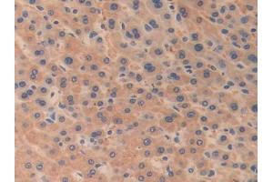 Figure. (ODC1 anticorps  (AA 15-259))