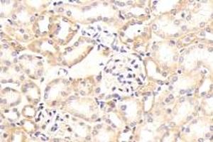 Immunohistochemistry analysis of paraffin-embedded mouse kidney using Integrin alpha V (ABIN7074314) at dilution of 1: 1000 (CD51 anticorps)