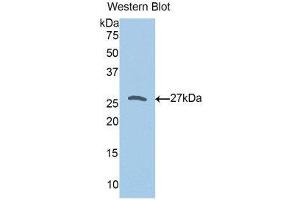 Western Blotting (WB) image for anti-Peroxiredoxin 3 (PRDX3) (AA 5-233) antibody (ABIN1176483) (Peroxiredoxin 3 anticorps  (AA 5-233))