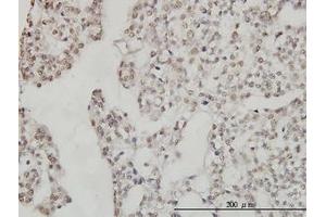 Image no. 5 for anti-DEAD (Asp-Glu-Ala-Asp) Box Polypeptide 54 (DDX54) (AA 778-882) antibody (ABIN599302) (DDX54 anticorps  (AA 778-882))